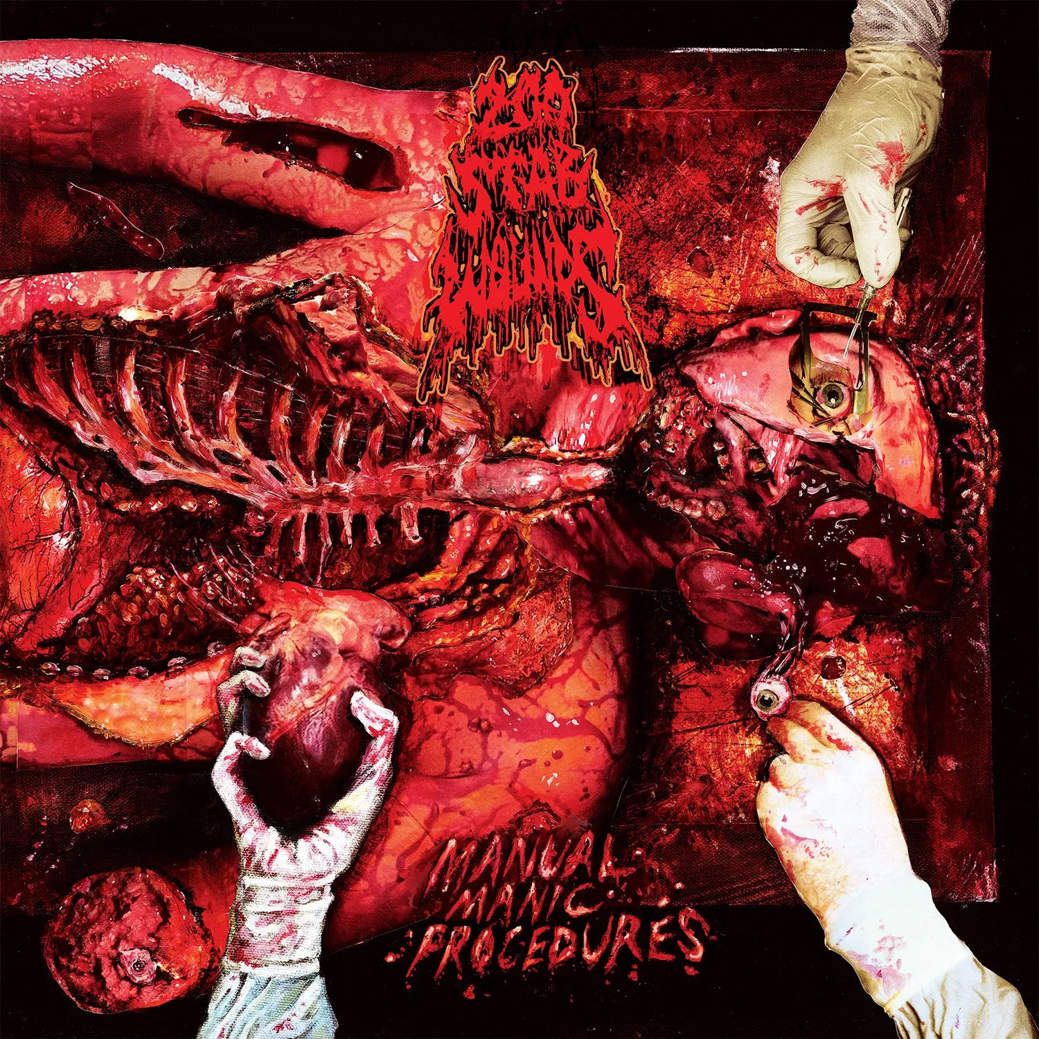 200 STAB WOUNDS "Manual Manic Procedures" CD